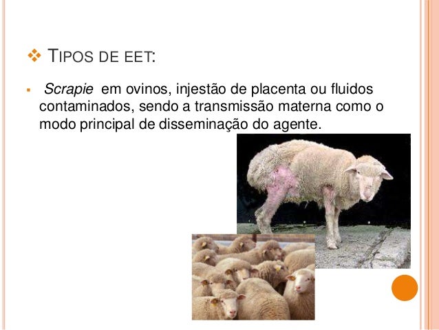 encefalopatias espongiformes transmissveis